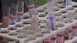 „მხარს ვუჭერ შიდსის დამარცხებას!“