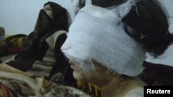 A wounded girl in Baba Amro, a neighborhood of Homs
