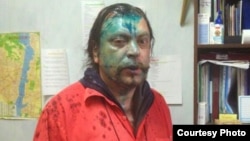 Andrei Yurov says two masked men hit him and splashed the indelible green antiseptic known as "zelyonka" on his face.