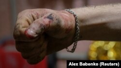 Mâna unui soldat ucrainean aflat la un punct de stabilizare medicală de pe linia frontului, 28 februarie.