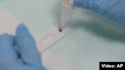 За даними вчених, трансплантація змінила імунну систему пацієнта і дала йому імунітет до ВІЛ, який мав донор