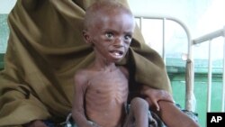 A malnourished child from southern Somalia sits in Banadir hospital in Mogadishu.