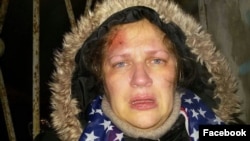 Ксения Сычева после нападения