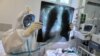 Ілюстрацыйнае фота. Мэдык у маскоўскім шпіталі праглядае здымак лёгкіх хворага на каранавірус