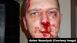 На снимке: саратовский журналист Сергей Вилков после нападения неизвестных