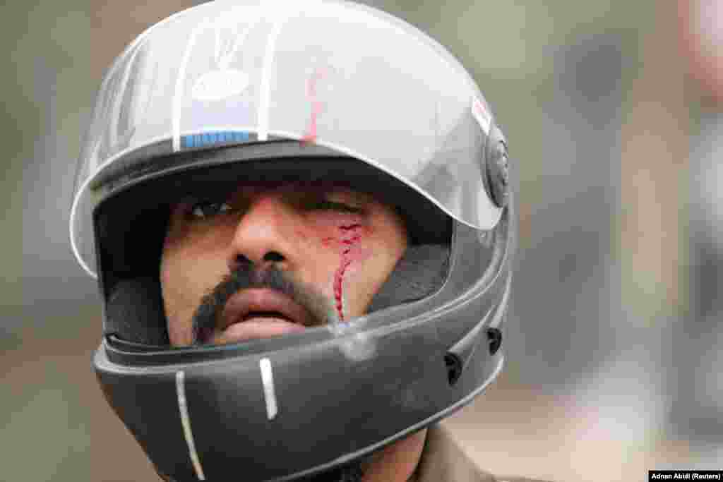 A man with a wounded eye is pictured during a protest in Seelampur on December 17.