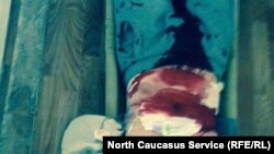 Житель дагестанского села Рутул Аким Кулиев порезал себя, не выдержав пыток сотрудниками ЦПЭ