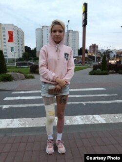 Крысьціна