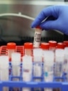 Laboratorija (fotoarhiva)
