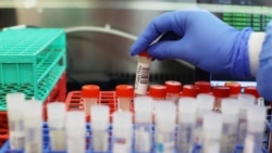 Diňle: Daşary ýurtlardan barýan türkmenistanlylar COVID-19 synagyndan geçmek talabyndan nägile bolýarlar