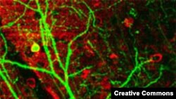 Нейроны коры головного мозга мыши, подсвеченные зеленым флуоресцентным белком. <a href="http://en.wikipedia.org/wiki/Neuron" target=_blank>Creative Commons. Wikipedia</a>