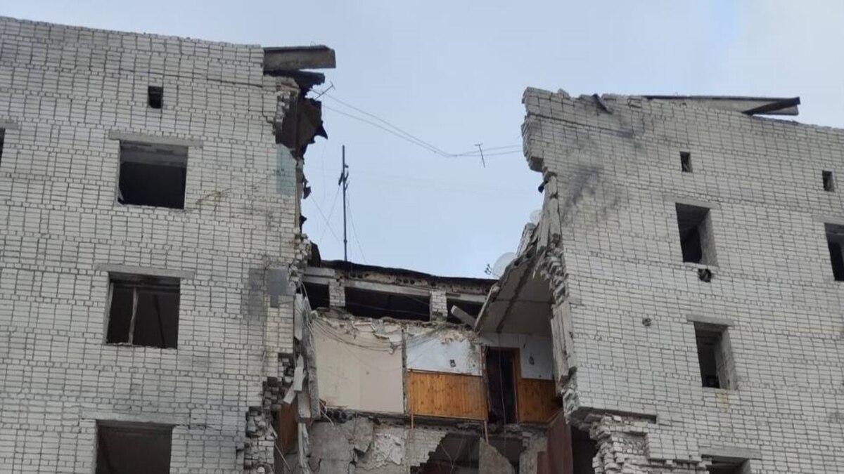 через російські обстріли постраждали троє жителів Сумщини, з них двоє дітей через російські обстріли постраждали троє жителів Сумщини, з них двоє дітей