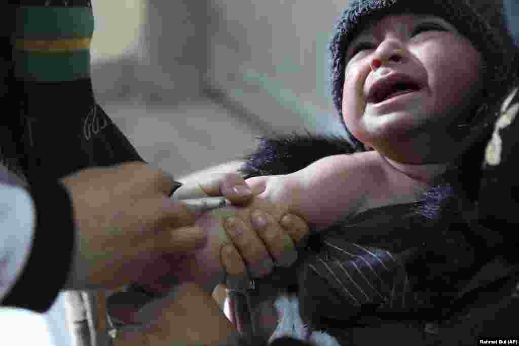 A child receives a measles vaccine at the Indira Gandhi Children&#39;s Hospital in Kabul. (AP/Rahmat Gul)