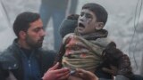 Сирийский мальчик, раненый, по словам оппозиционных активистов, в результате авиаудара сил президента Башара Асада.