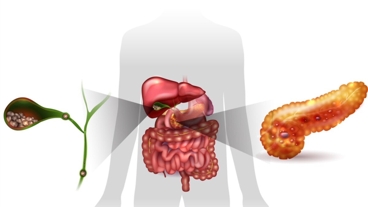 Камни в желчном пузыре и поджелудочная железа