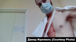 David Frenkel suffered a broken bone in the incident at a St. Petersburg polling station in late June. 