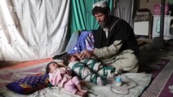 Житель Афганистана вынужден продать одного из сыновей-тройняшек