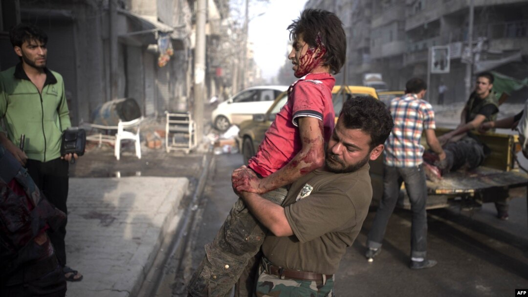 A fighter injured in the Arqub neighborhood of northern city of Aleppo is brought to a hospital on October 1.