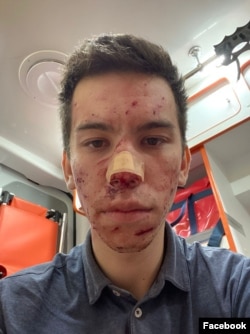 Александр Наумов после нападения