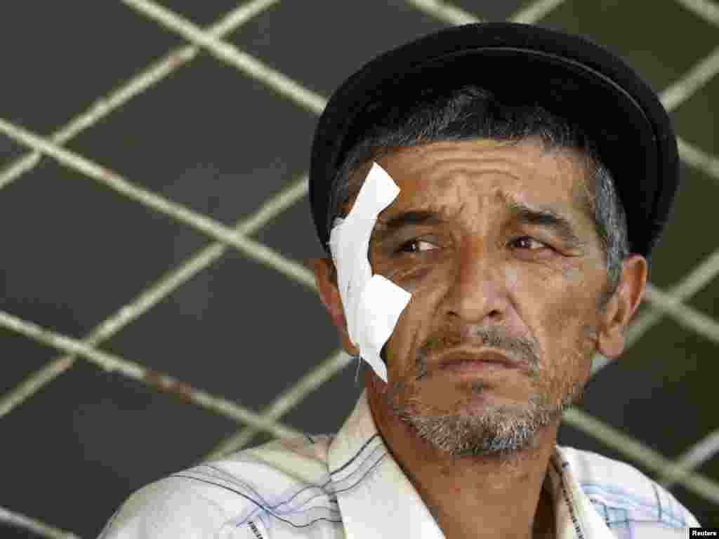 Раненый узбек-беженец. Ош, 20 июня 2010 года.