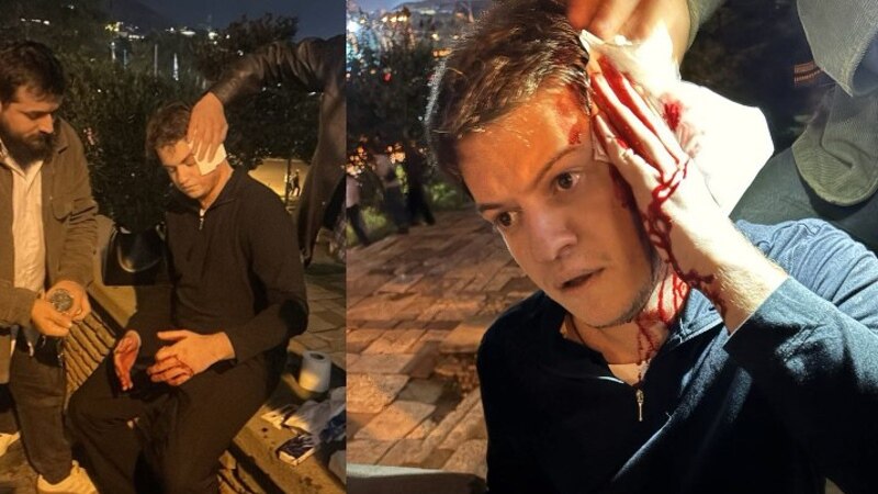 თავს დაესხნენ „ნაციონალური მოძრაობის“ ახალგაზრდულის ლიდერ იგორ ნარმანიას