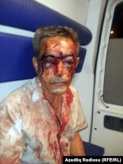 Journalist İlgar Nasibov was brutally beaten in August.