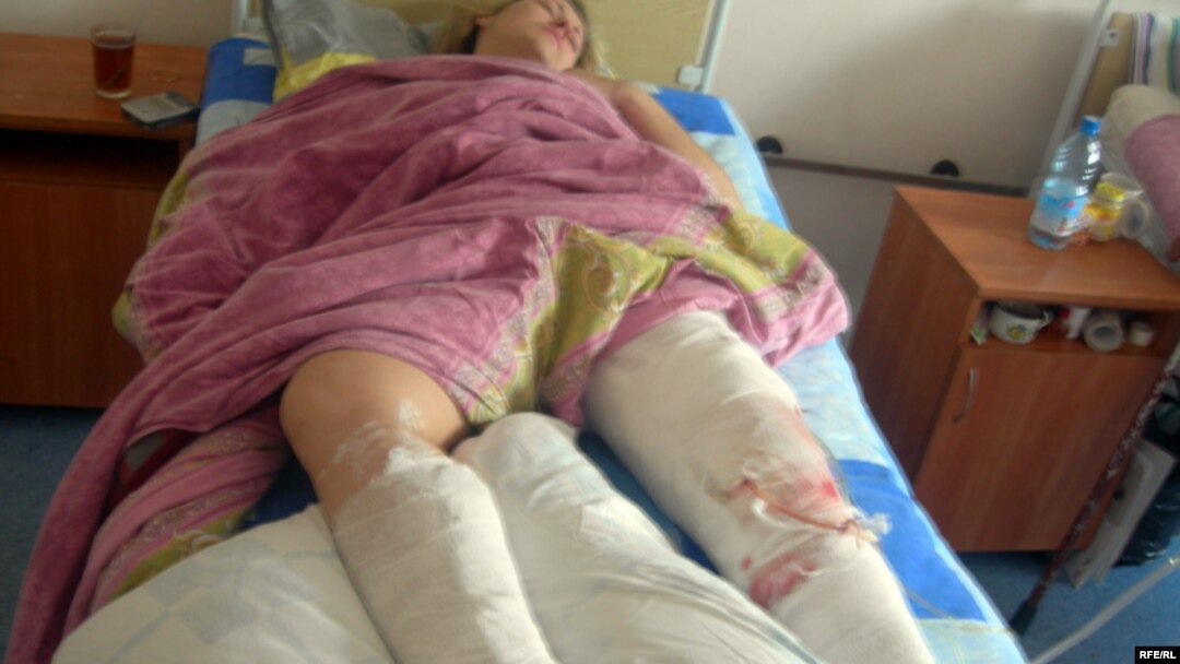 One of the injured in the Minsk explosion