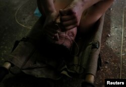 Military governmental rănit în Artemivsk, 8 febr., 2015