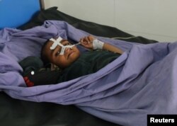 An Afghan child receives treatment at a hospital after an April 2 air strike in Kunduz Province.