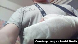 A picture of a VKontakte employee who says he was beaten up by unknown assailants, possibly for antigovernment comments he posted online. 