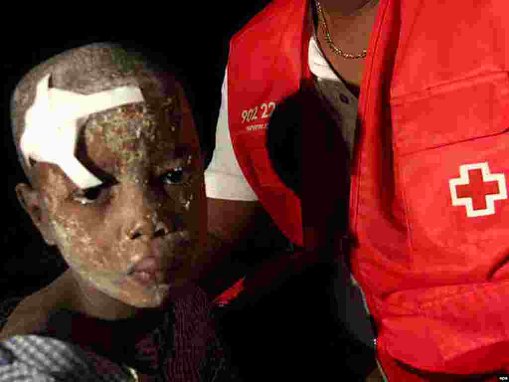 Повредено момче во Порт о Пренс