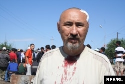 Шаңырақ оқиғасы кезінде жараланған Арон Атабек. Алматы, Шаңырақ, 14 шілде 2006 жыл.