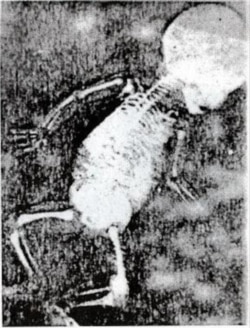 Перша у світі рентгенограма цілого організму людини (дитини), зроблена Іваном Пулюєм. Лютий 1896 року