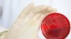 کشف ۲۰۰ مورد جديد از ابتلا به بیماری باکتری «ا. کولی» در آلمان