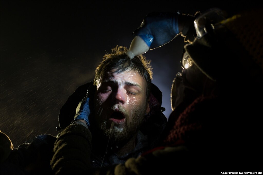 Një burrë mjekohet me qumësht, pasi është lënduar nga sprei. Policia në Standing Rock, në Dakodën Veriore, kishte përdorur sprej për të shpërndarë protestuesit.