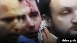 Лидерот на СДСМ Зоран Заев е повреден откако демонстрантите од „За заедничка Македонија“ упаднаа во Собранието на Република Македонија