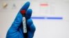 Halkara Olimpiýa komiteti: Ozalky doping rus resmisi 'dogruçyl şaýat'