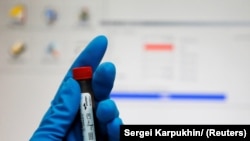 Russia -- A technician holds a test tube with a blood sample at the Russian anti-doping laboratory in Moscow