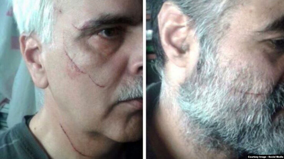 اثر چاقو بر صورت سعید مدنی (چپ) و سعید رضوی فقیه (راست)