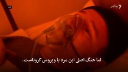 داکتران مبتلا به کرونا زخمی های جنگ را تداوی کرده اند