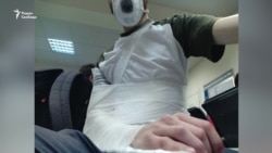 У Росії поліцейський зламав плече журналістові на дільниці для голосування (відео)