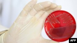 Напередодні деякі медіа повідомили про спалах скарлатини у Києві. Фото ілюстративне
