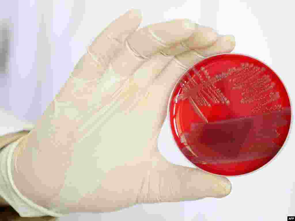 Європейські споживачі мають панічний страх перед вбивчою бактерією, що вже забрала життя 16 осіб. Попередні аналізи німецьких експертів вказували на те, що джерело зараження – іспанські огірки. Пізніше це твердження визнали помилкою, хоча криза призвела до багатомільйонних збитків фермерів Іспанії, Нідерландів та інших країн-експортерів. Тим часом, справжня причина поширення бактерії залишається загадкою. Photo by AFP 