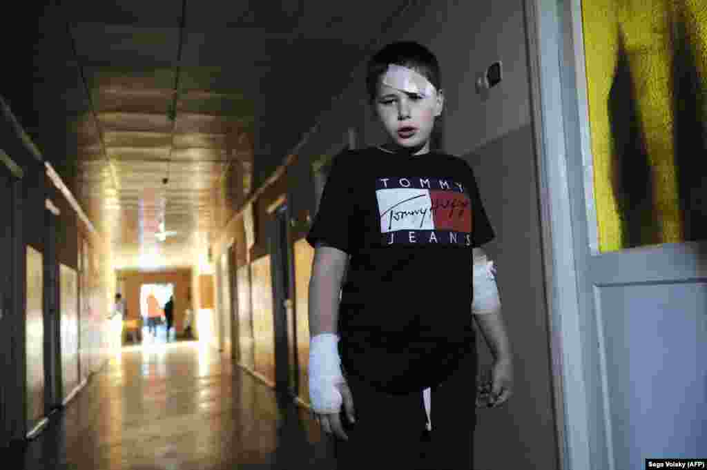 Dmitriy Vadimovich, 10, stands in the corridor of a hospital after he was injured in a land-mine explosion in the city of Gorlivka, 30 kilometers north of Donetsk, eastern Ukraine. Three children were killed in the blast. (AFP/Sega Volskii)