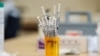 A koronavírus betegség elleni Pfizer-BioNTec-vakcina fecskendői az Egyesült Államokban, Illinoisban, 2021. február 22-én