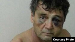 WhatsApp орқали Озодликка йўлланган бу сурат қийноққа солинган А. Акбаровга тегишли экани айтилди.