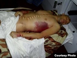 Тело заключенного Шамиля Ярославлева со следами жесткого избиения и пыток. 5 ноября 2011 года.