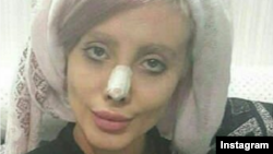 Sahar Tabar in one of the photos posted on her Instagram account, showing her after a nose surgery.