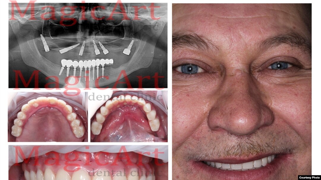 A happy dental-implant customer in Belarus.