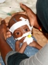 APTOPIX Somalia Severe Hunger